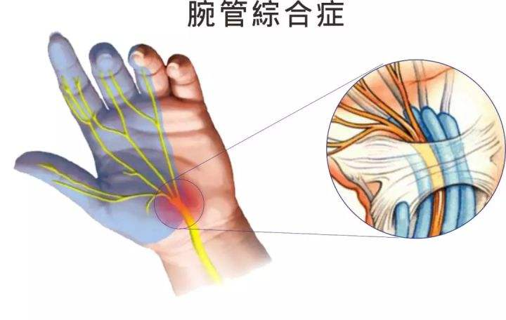 手指头发麻是什么原因图片