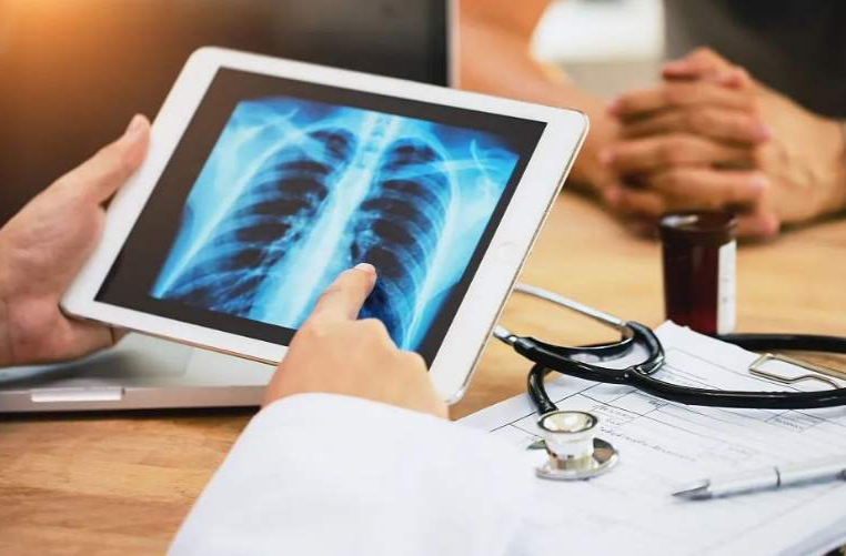 不吸烟也会患上肺癌？这些诱因一定要注意