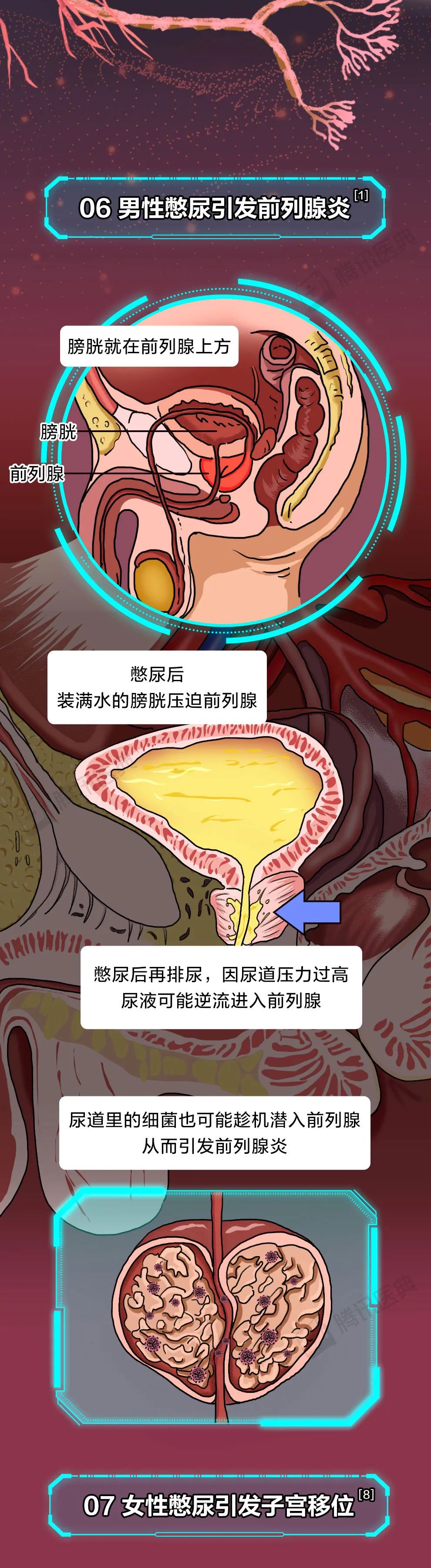 男人膀胱 女性图片