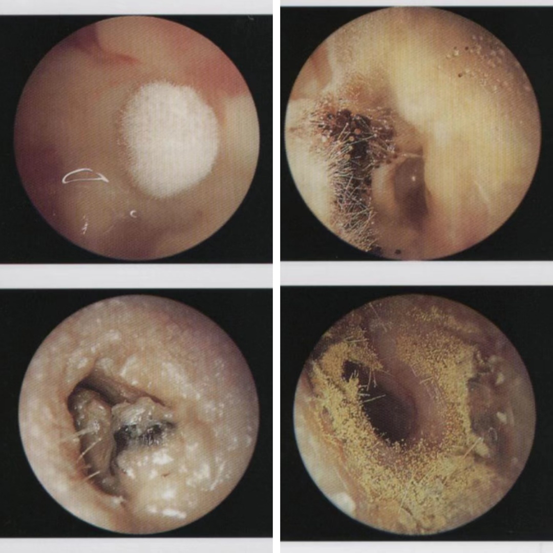耳朵内部有白色鼓泡图片