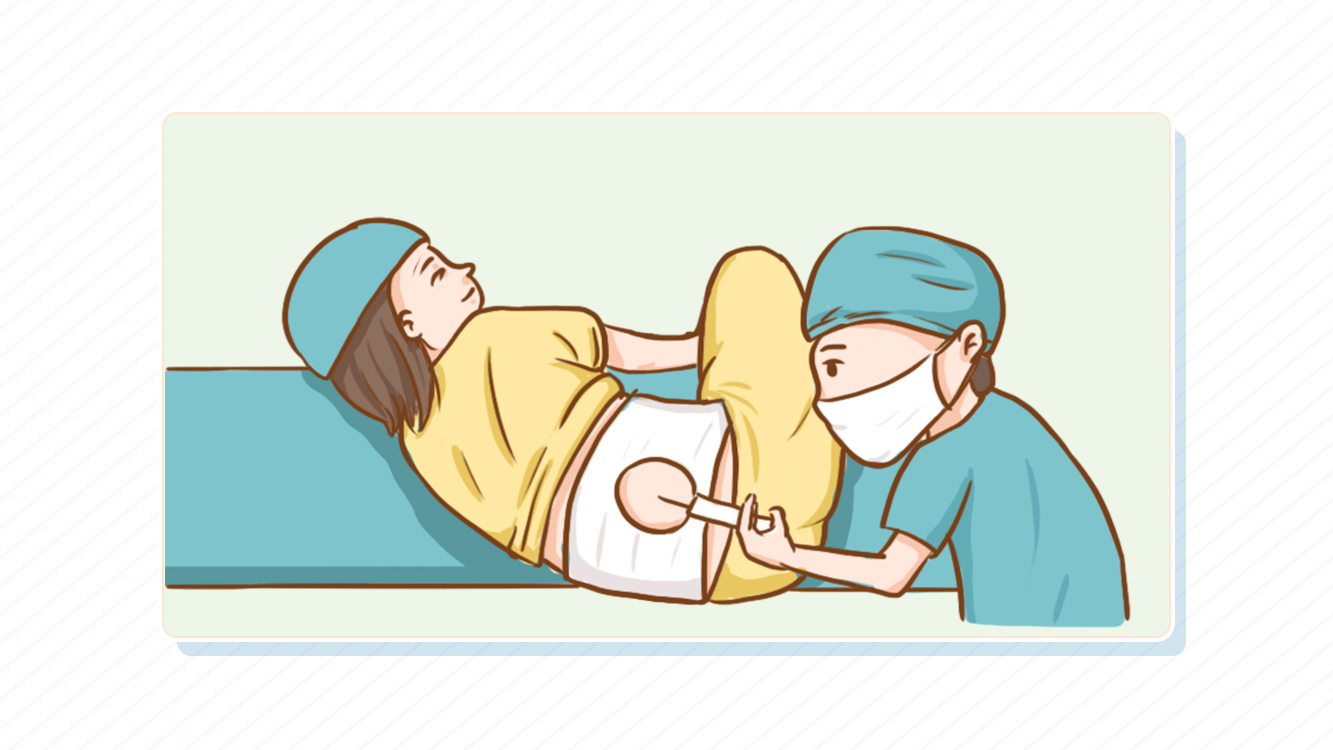 其实生娃可不用那么痛,准妈妈们需要了解一下分娩镇痛!