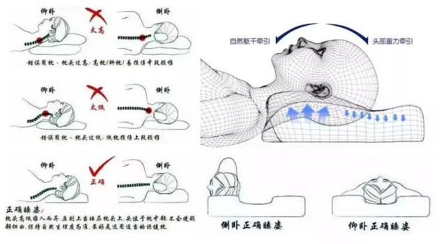 经常落枕的"歪脖子星人-新湖南