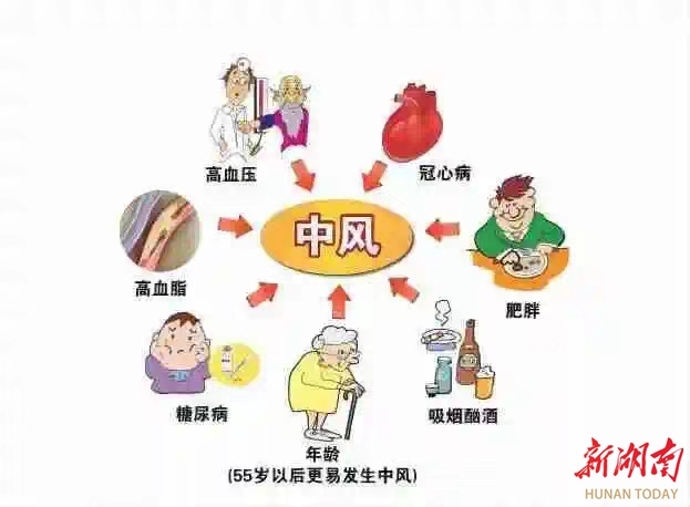 短暂性脑缺血发作又称"小中风","小卒中",发作时症状与卒中非常相似