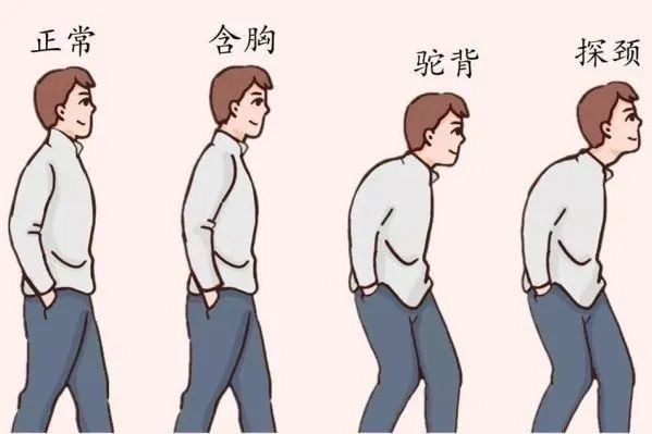 孩子站没站相，坐没坐相？可能是出现了不良体态