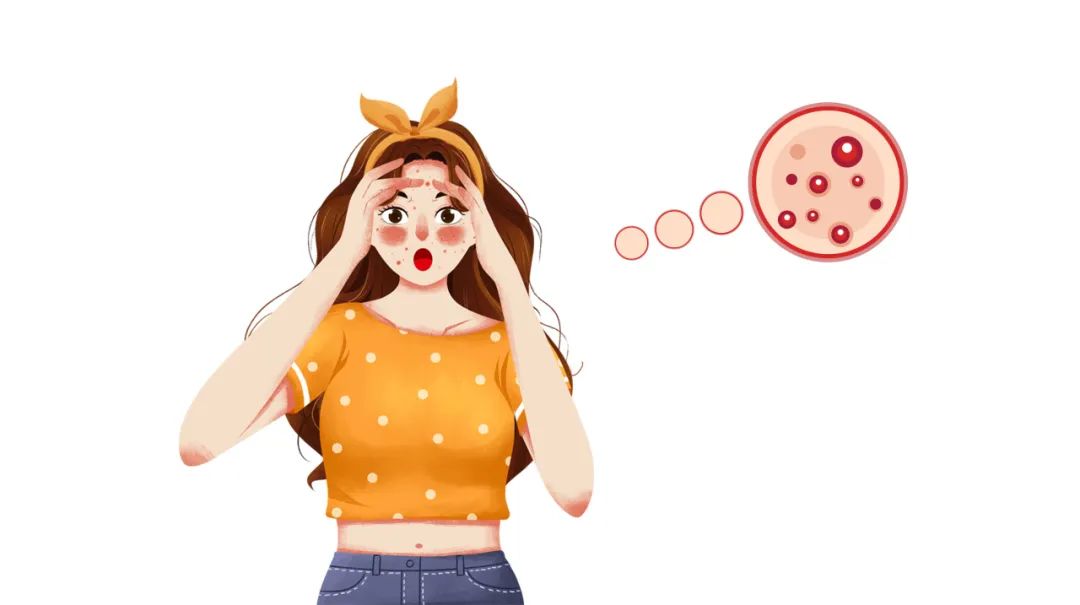 关于青春痘的误区你知道几个？去除青春痘你可以这样做