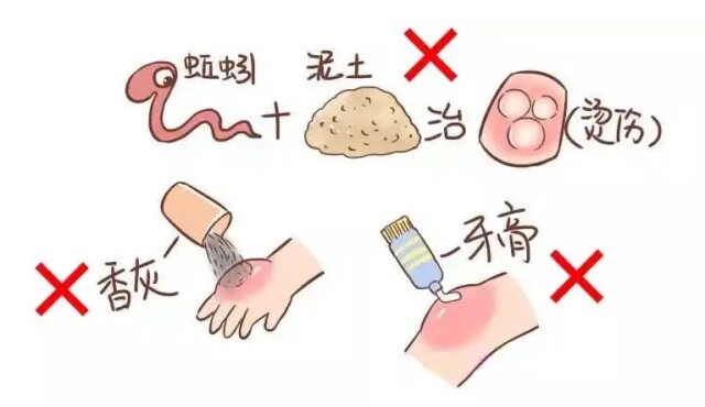 温度连升烧伤烫伤事故多发你该知道这样处理