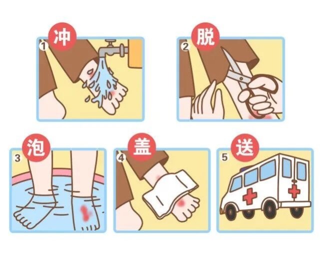 温度连升烧伤烫伤事故多发你该知道这样处理