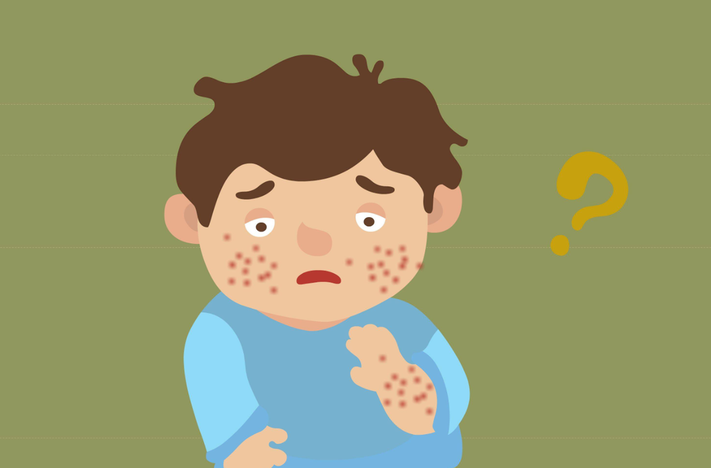 过敏多发 “元凶”就在身边