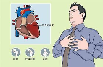 中国疾控刊发：降低心血管疾病风险，6种食物是关键