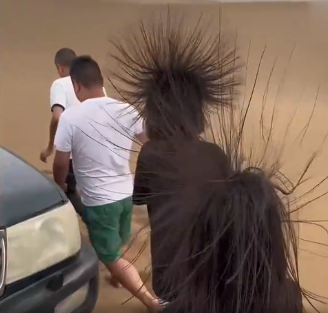 危险！游客头发突然竖起变“海胆”？专家：不能跑