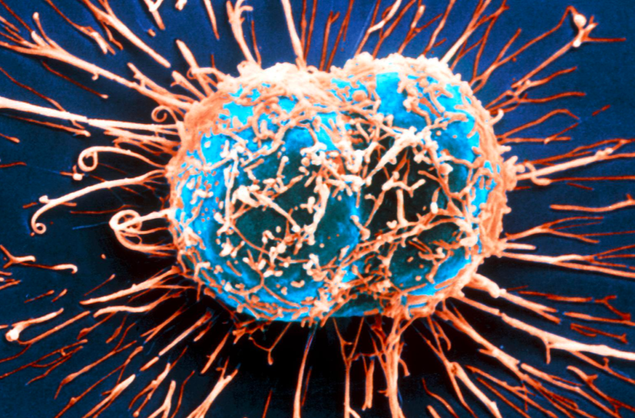 超灵敏血检可量化“泛癌”生物标志物