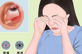 如何应对过敏性结膜炎？专家支招