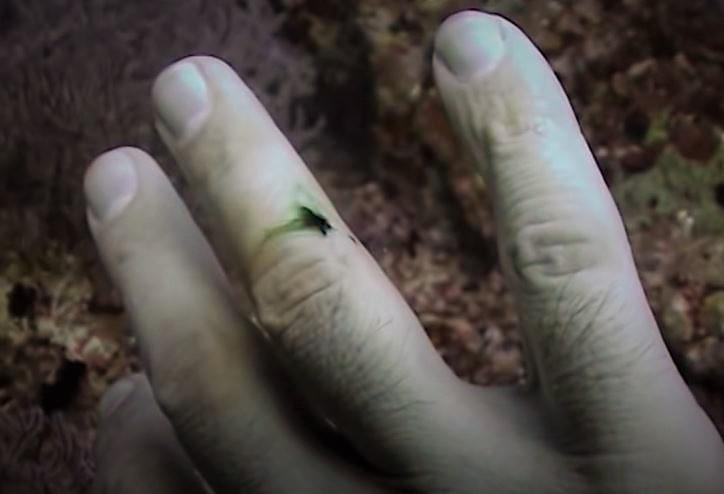 潜水员在水下被海鳗咬伤，他流的血变成了绿色的……