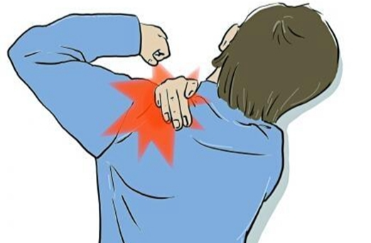 误把肩痛当肩周炎，小心越治越重！